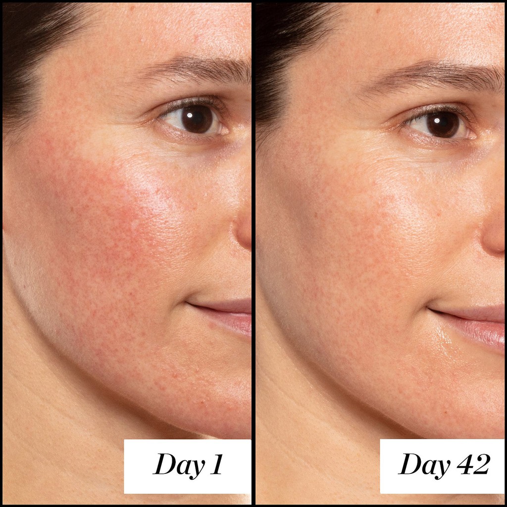 A+ High Dose Retinoid Serum tinh chất sáng da, chống lão hóa
