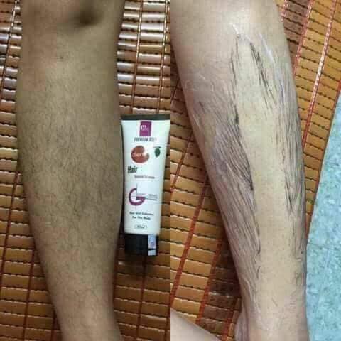 Kem Tẩy Lông Cherry [ TẶNG NẠ VITAMIN ] | BigBuy360 - bigbuy360.vn