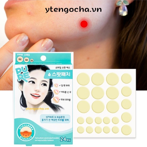 Miếng dán mụn Somaderm Spot 24pcs, 3 size, 24 miếng, băng dán hydrocolloid hút dịch, hút mụn liền da, hạn chế sẹo