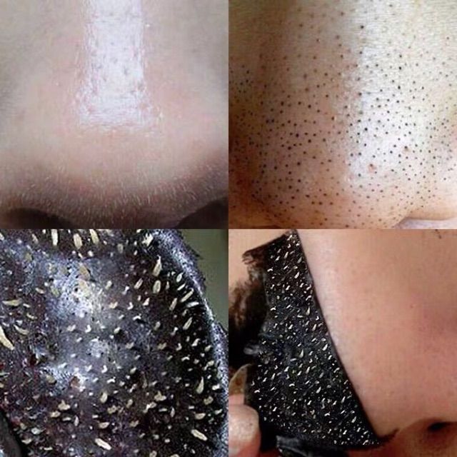 Gel lột Mụn Than Tre Bioaqua Charcoal ♥️FREESHIP♥️ Hút sạch mụn cám, mụn đầu đen. Thải độc chì- Sáng da