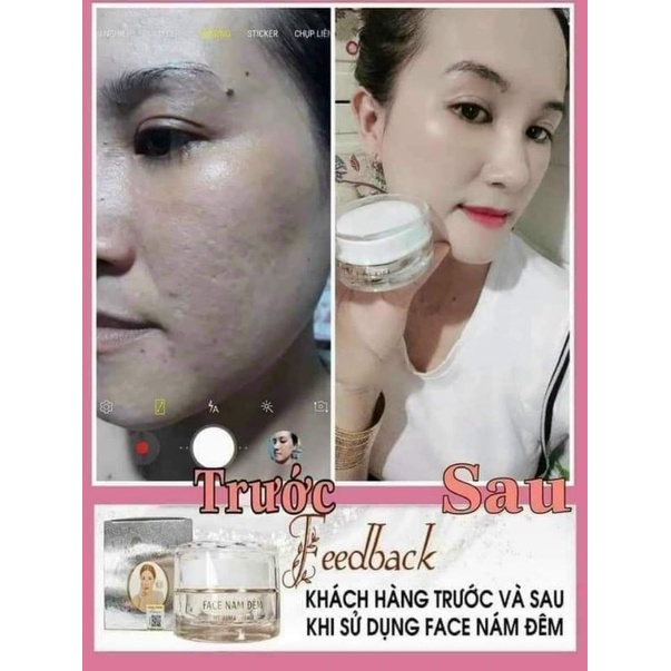 Nám Đêm Ncollagen Trần Bích Ngân