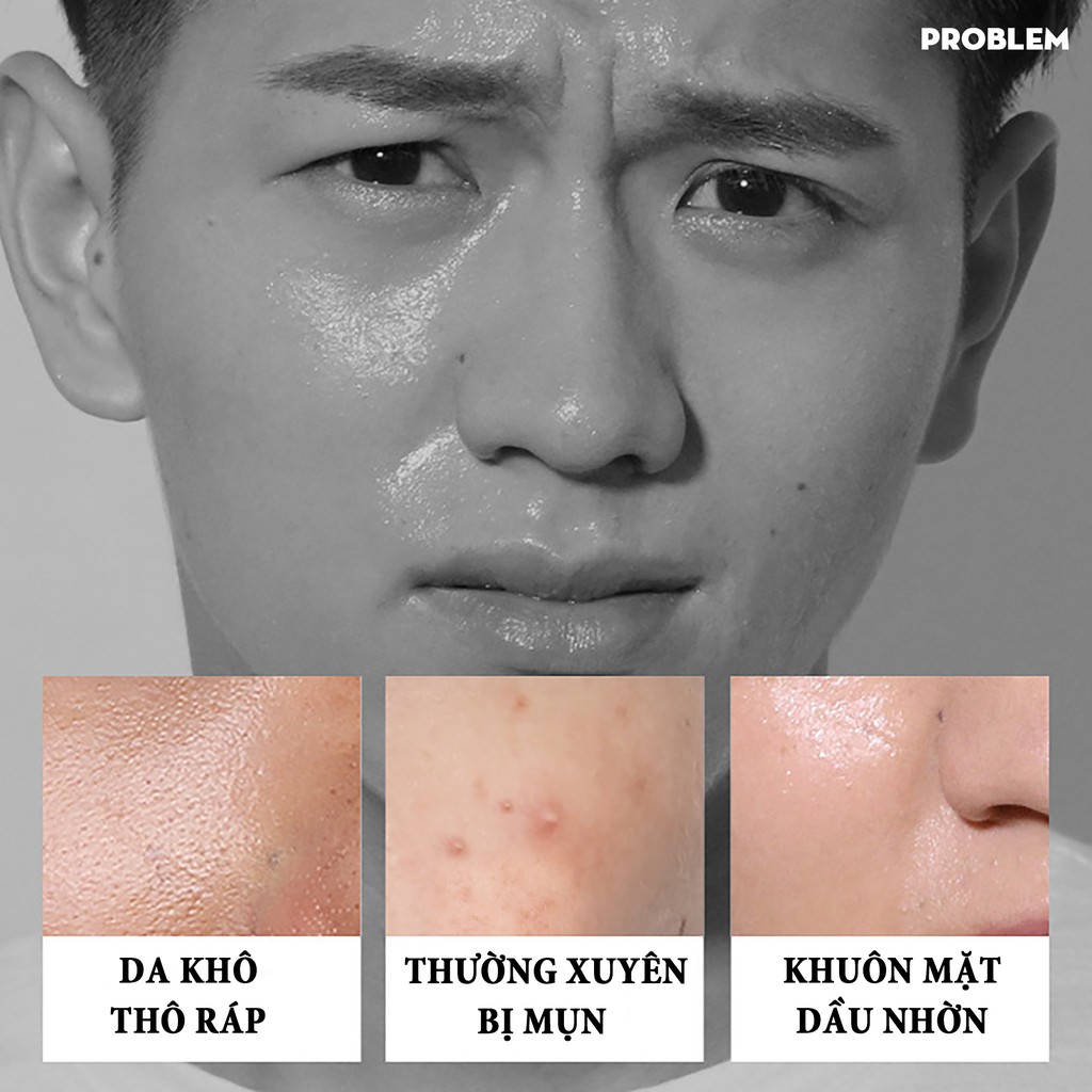 Sữa Rửa Mặt Tạo Bọt Cho Nam Iceman BLUEMAN, Ngừa Mụn & Làm Sáng Da ZL56 | BigBuy360 - bigbuy360.vn