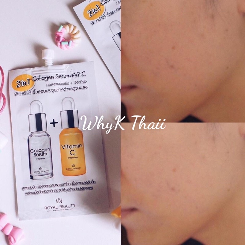Serum dưỡng trắng da Royal Beauty Collagen Serum Vit C 8ml