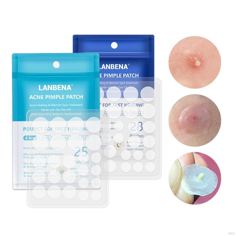 [Hàng mới về] Lanbena Miếng dán mụn dùng để che khuyết điểm làm đẹp hoặc trang điểm | BigBuy360 - bigbuy360.vn