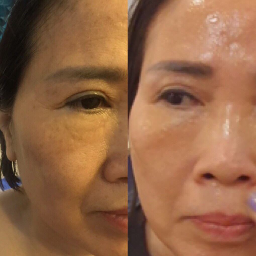 CHÍNH HÃNG GCOOP Mặt nạ gel nâng cơ xóa nhăn cấp tốc Lifting Gel Carecella