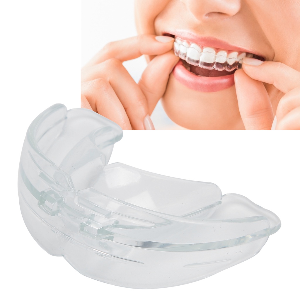 Niềng răng chỉnh nha màu sắc trong suốt tiện lợi