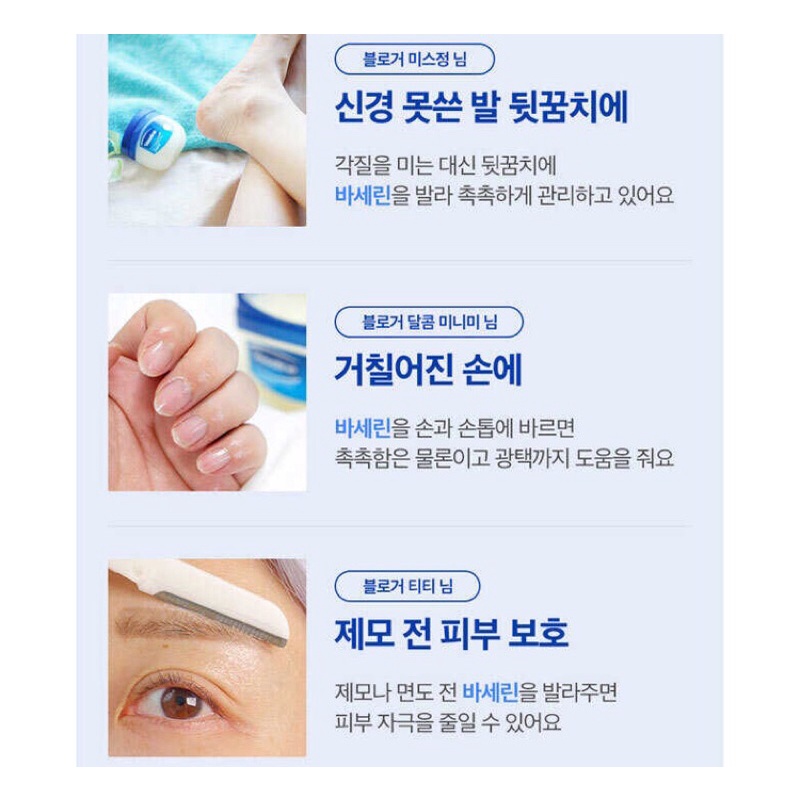 DƯỠNG VASELINE ĐA NĂNG 100G | BigBuy360 - bigbuy360.vn