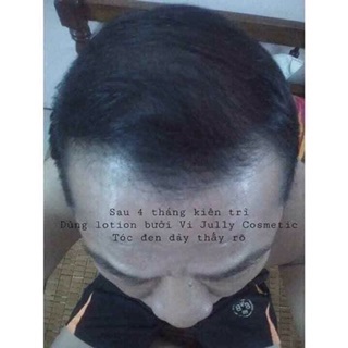 TINH DẦU BƯỞI TRỊ RỤNG TÓC VIJULLY