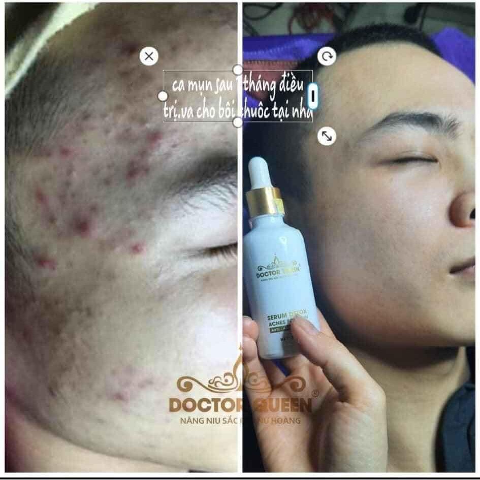 DETOX MUN DOCTOR QUEEN