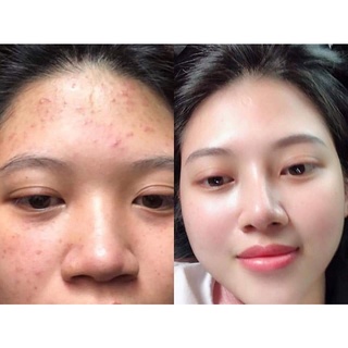 Tinh dầu gấc 450k/10ml