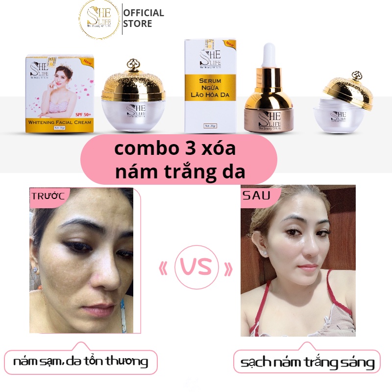 Bộ 3 Cải Thiện Nám Tàn Nhang Ngày Đêm She Life