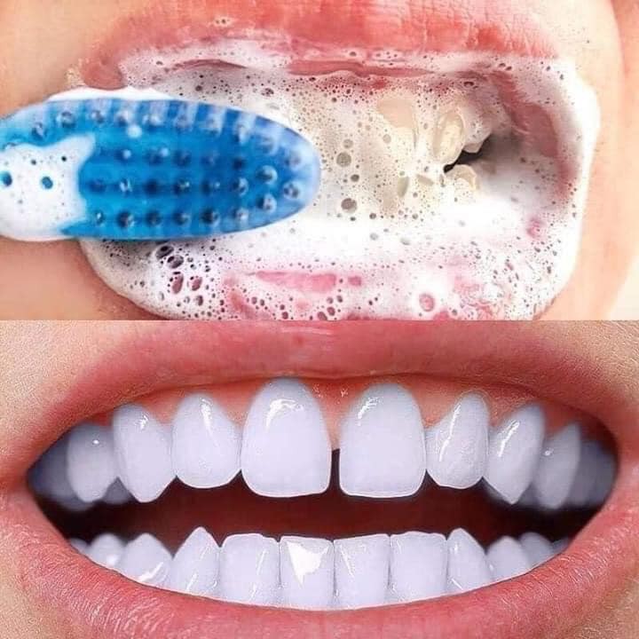 [Sale 1k giá hủy duyệt] Kem Đánh Răng Sensodyne