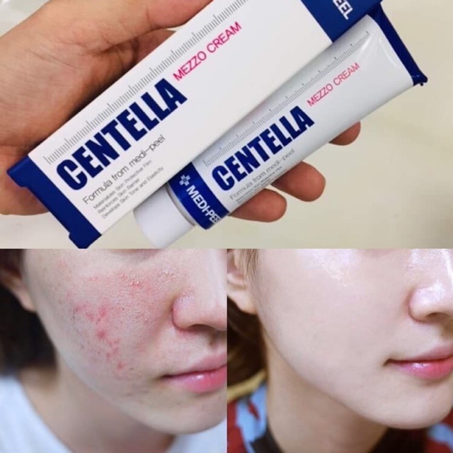 KEM TẾ BÀO GỐC CENTELLA MEDI-PEEL