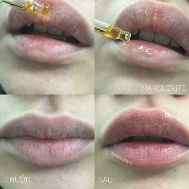 SERUM DƯỠNG MÔI GIẢM THÂM MÔI. | BigBuy360 - bigbuy360.vn