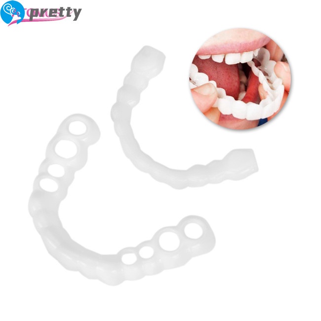 [Hàng mới về] Cặp niềng răng trắng tái sử dụng được tiện lợi