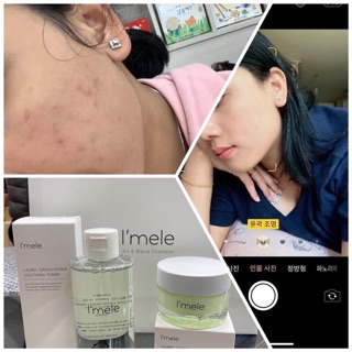 [Mẫu Thử] Bộ Dưỡng Dành Cho Da Mụn I'MeLe