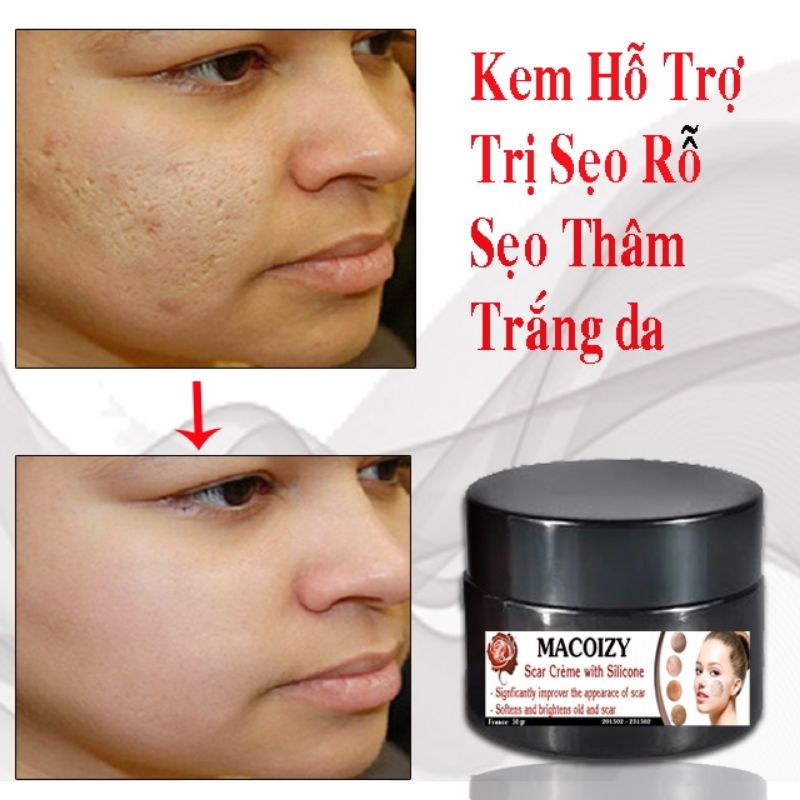 Kem Xóa Sẹo Rỗ Sẹo Mụn Sẹo Thâm