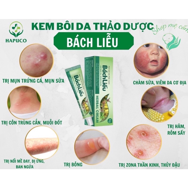 Kem Bôi Da Bách Liễu