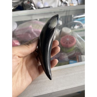 Cạo gió sừng diện chẩn