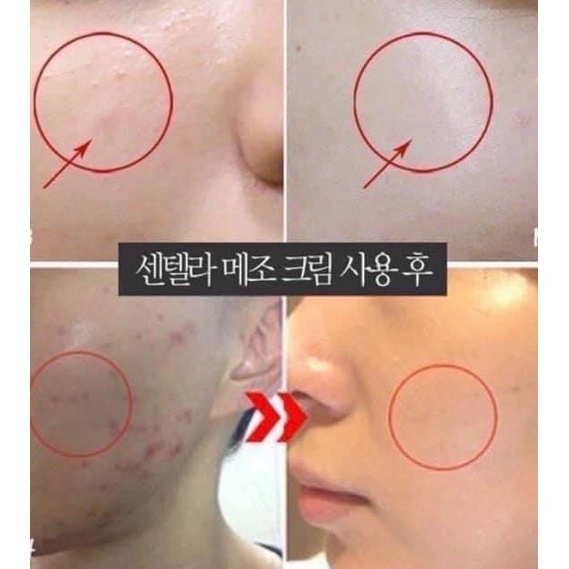 KEM DƯỠNG A313 -RETINOL 0.12% | BigBuy360 - bigbuy360.vn