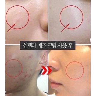 KEM DƯỠNG A313 -RETINOL 0.12%