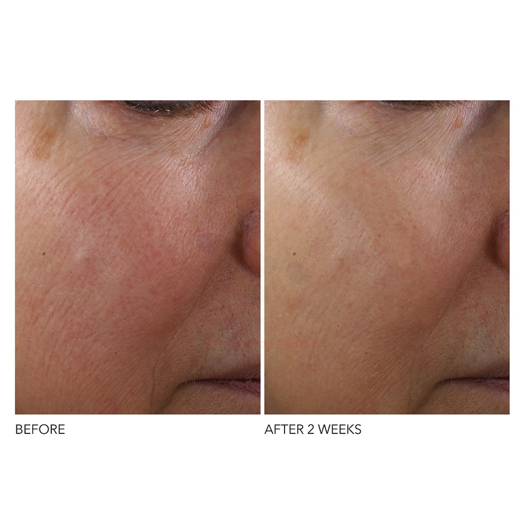 DR DENNIS GROSS 🌿  Tinh chất chống lão hoá Skincare Advanced Retinol + Ferulic Texture Renewal Serum