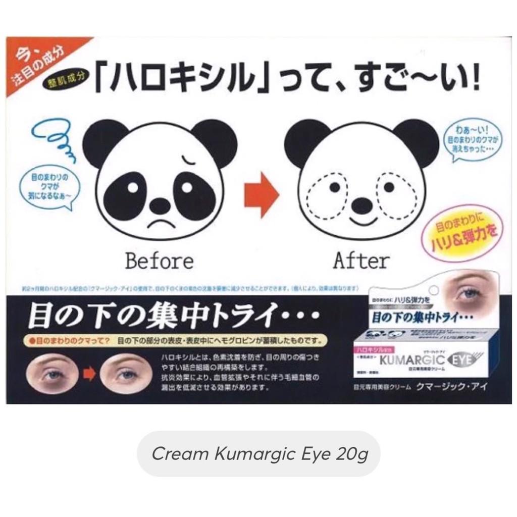 Kem THÂM QUẦNG MẮT Kumargic Eye Nhật Bản 20g mờ thâm quầng mắt, bọng mắt, giảm nếp nhăn, vết chân chim | BigBuy360 - bigbuy360.vn
