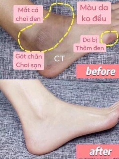 SỮA TẮM YESNOW TẨY DA CHẾT