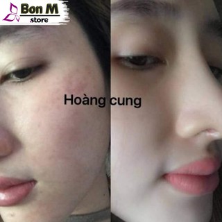 Bộ đôi hoàng cung Hồng (chuẩn 100%)