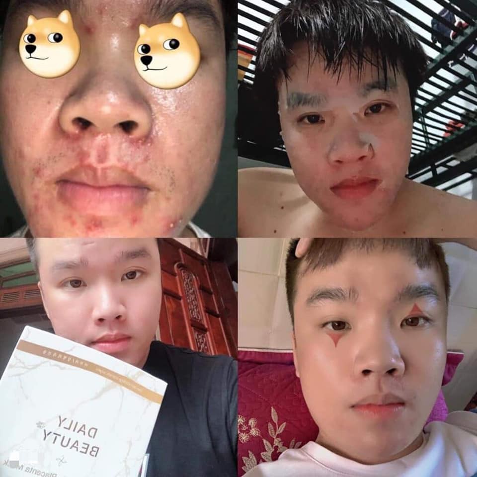 Mặt Nạ Làm Trắng, Hỗ Trợ Điều Trị Mụn, Làm Mờ Thâm Nám, Chống Nhăn Multi Peptide Placenta Mask Hàn Quốc