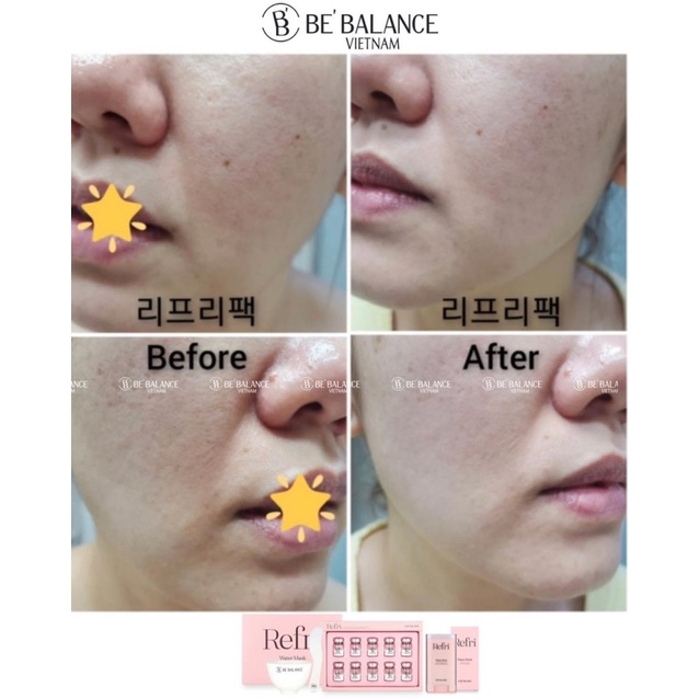 Kem dữơng PHỤC HỒI dạng lăn REFRI WATER STICK