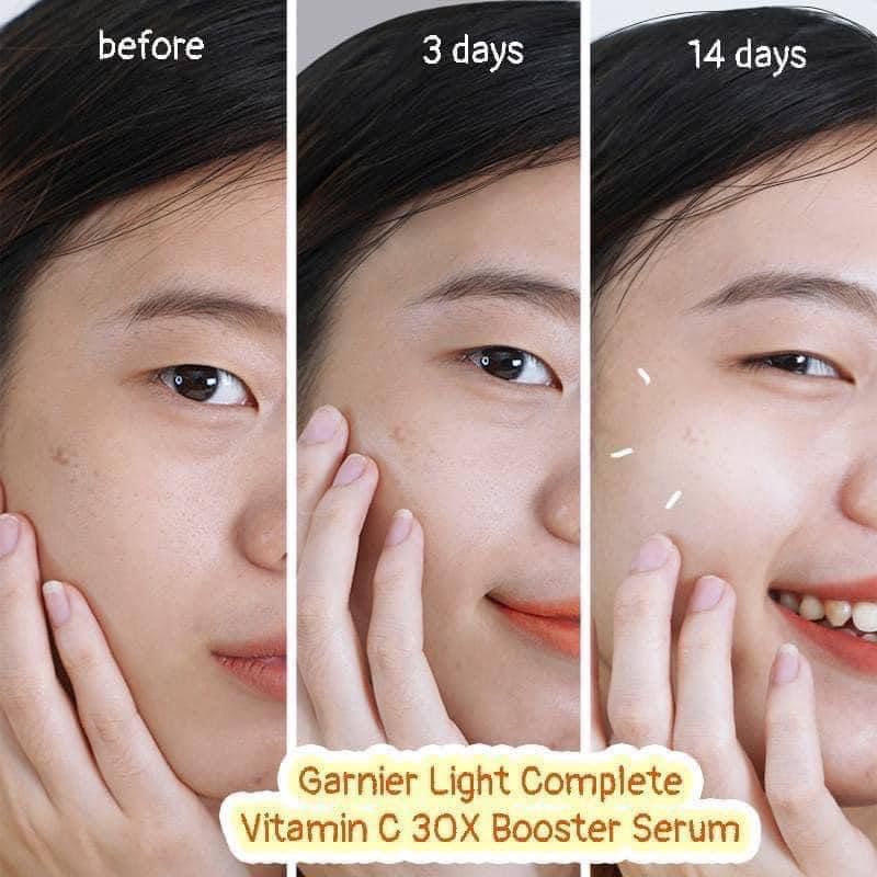 SERUM + KEM DƯỠNG GARNIER VITAMIN C Đức