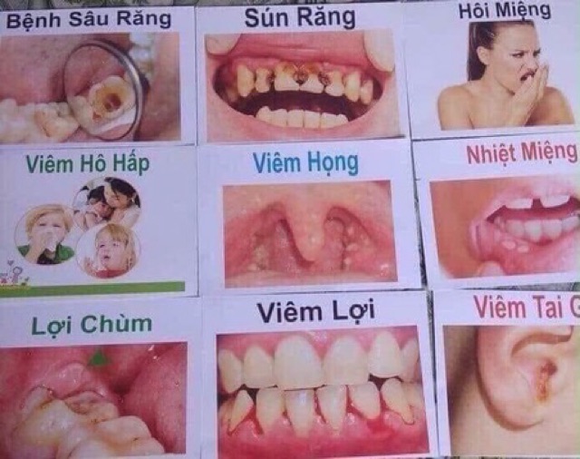 Tinh dầu răng miệng sâu răng hôi miệng Dạ Thảo Liên