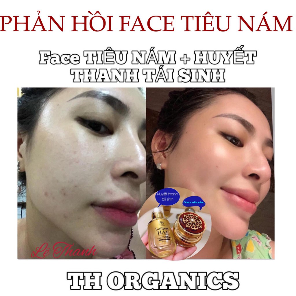 Face tiêu nám dưỡng trắng mờ thâm Saffron TH Organics
