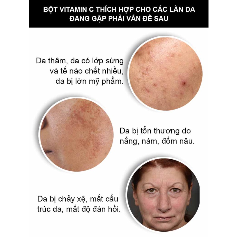 10gr Vitamin C Kích Trắng Da, Mờ Thâm Mụn