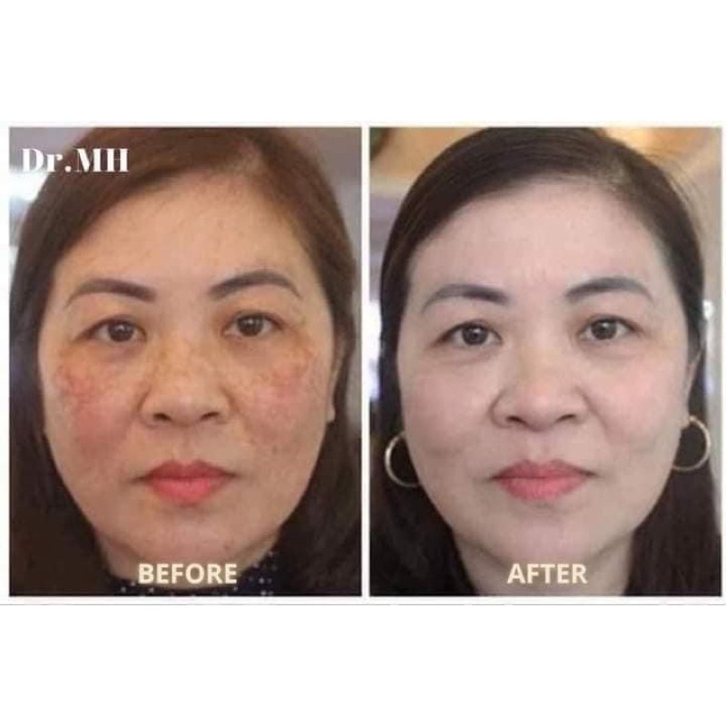 Kem Nám Dr.MH Mela Q Plus Cream Hàn Quốc, Giúp Ngăn Ngừa Nám Tàn Nhang, Dưỡng Trắng Da Và Chống Lão Hóa - 50ml Auth