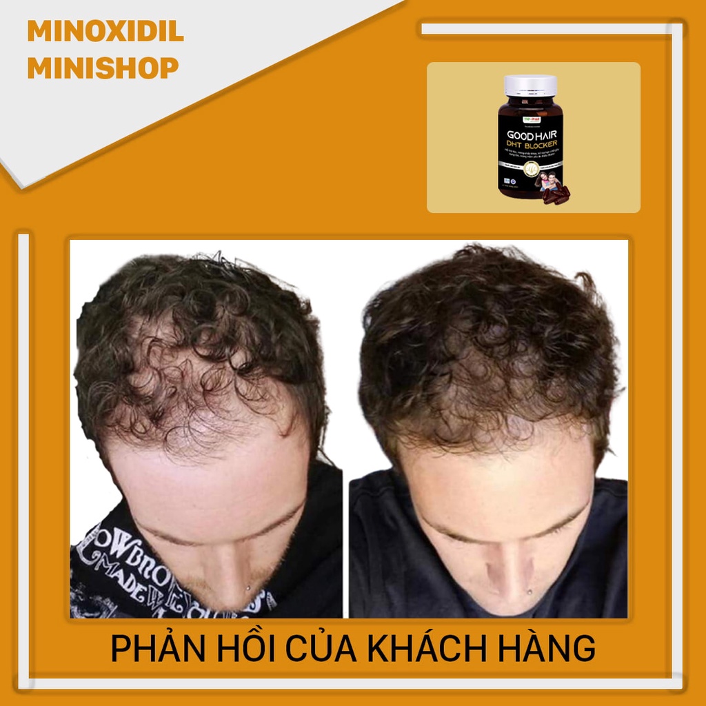 DHT BLOCKER GOOD HAIR Chặn DHT - Ngăn Rụng Tóc