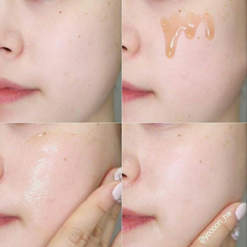 Tinh chất HYGGEE NATURAL REPAIR SERUM