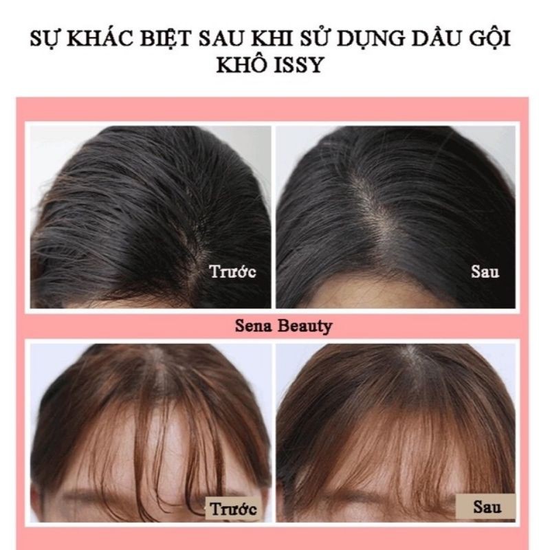 Dầu gội đầu khô issy 150ml