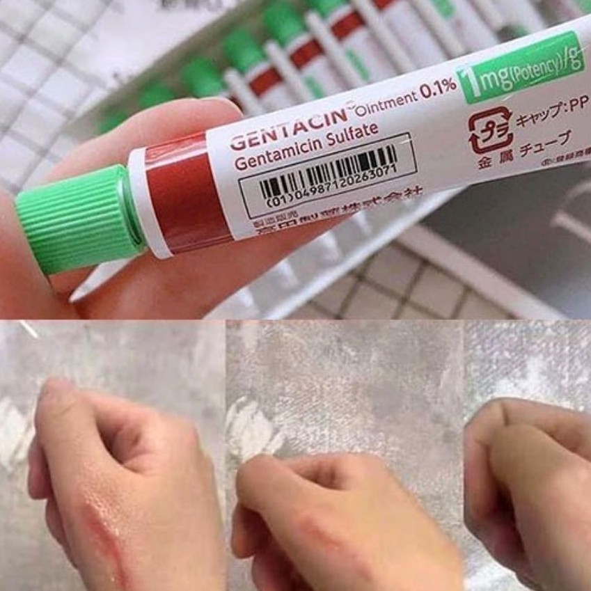 Gentacin 💕 Gentacin Nhật Bản - Chính hãng - Giảm thiểu việc hình thành sẹo và mụn | BigBuy360 - bigbuy360.vn
