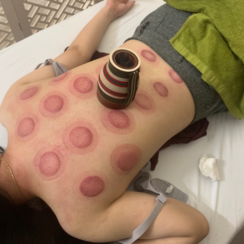 Cốc Phù Dương Xông Hơ Ngải Cứu Hàn Ẩm Massage, Giác Hơi, Cạo Gió, Chải Thông Kinh Lạc (Tặng Ngải, Bản Đồ Huyệt,Tinh Dầu)