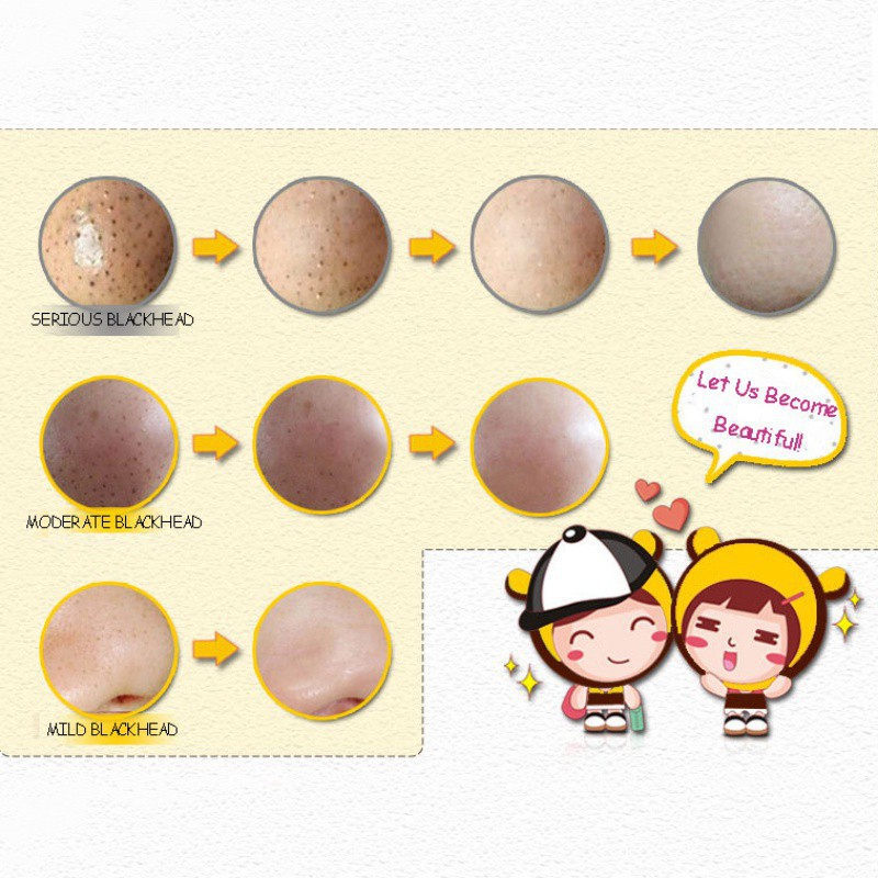 1 Mặt Nạ Mũi Lột Mụn Đầu Đen Làm Sạch Da