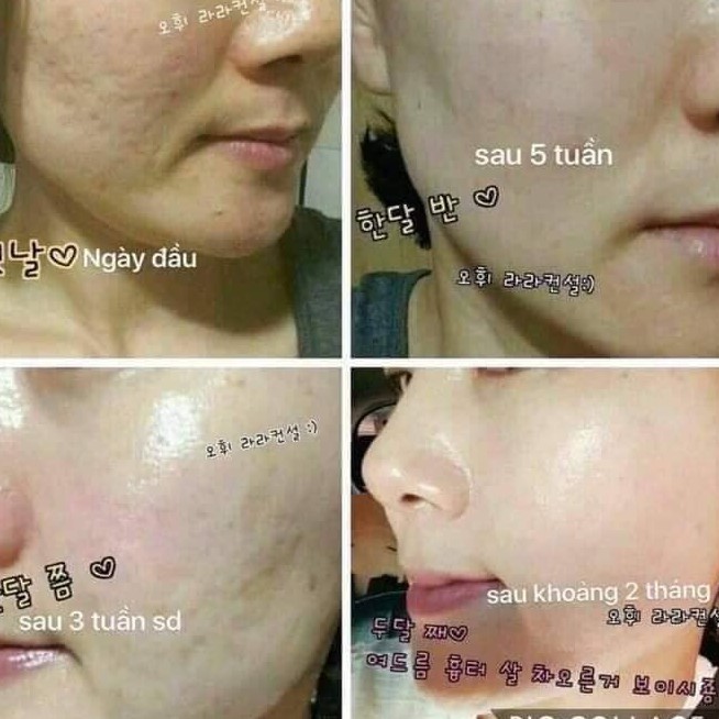 10 GÓI TINH CHẤT VÀNG ĐÊM OHUI GIÚP TÁI SINH DA, SE KHÍT LỖ CHÂN LÔNG, NGĂN NGỪA LÃO HÓA