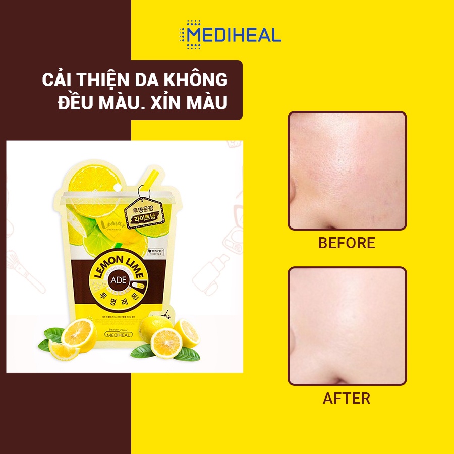 [Nhập mã COSMH22 giảm 8%] Mặt Nạ Tinh Chất Chanh Tươi Giúp Trắng Sáng Da Mediheal Lemonlime Vita Mask 20ml [K13]