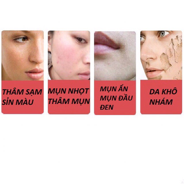 tuan073 Mặt nạ bã rượu sake ủ trắng dưỡng da mờ thâm ngăn ngừa mụn ẩn mụn đầu đen mask nội địa trung image tuan073