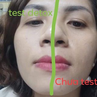 Mặt nạ thải độc 360k