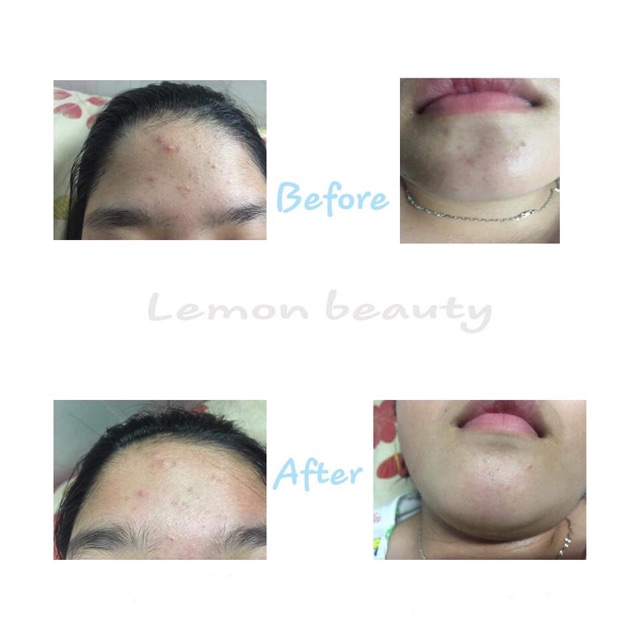 [ MUA 1 MASK TẶNG 1 MASK ] MASK KHỔ QUA RỪNG SALE 84K 🎁 MASK MÔI + CỌ + THÌA PHA | BigBuy360 - bigbuy360.vn