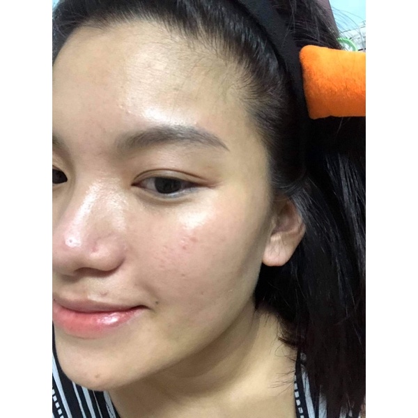 kem dưỡng ẩm cực kỳ tốt | BigBuy360 - bigbuy360.vn