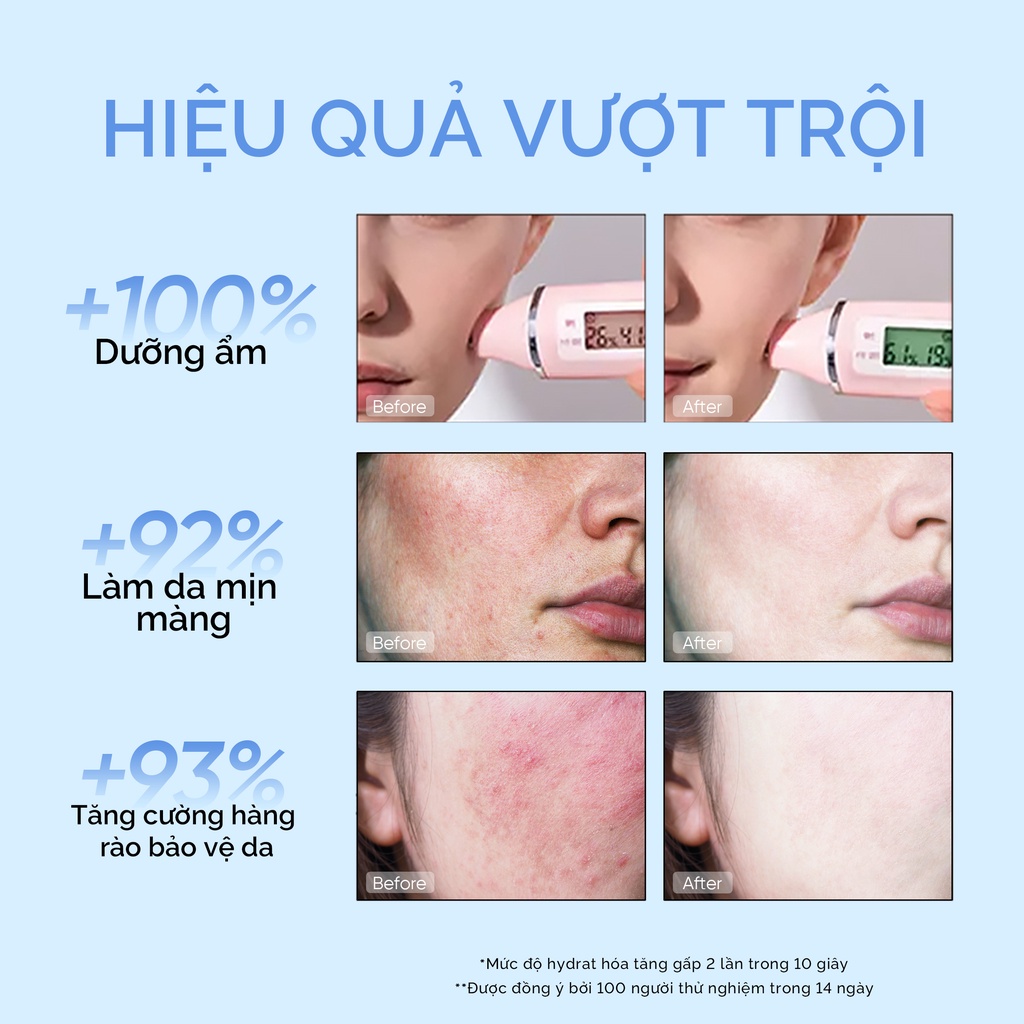 SKINTIFIC 4D Tinh chất nước hoa hồng chứa chất Axit Hyaluronic