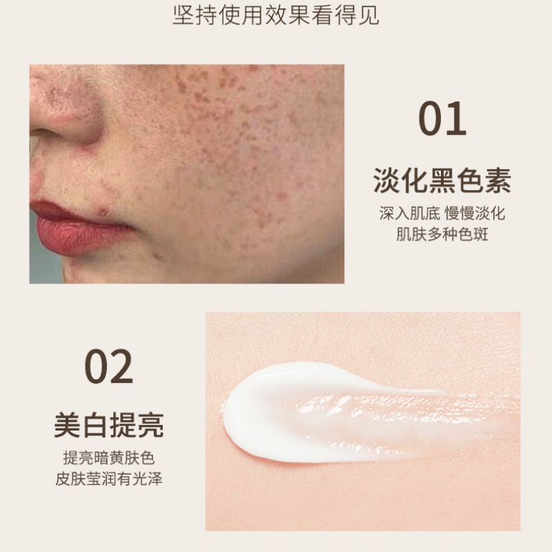 Kem Dưỡng Ẩm Làm Trắng Da Loại Bỏ Tàn Nhang Tiện Dụng